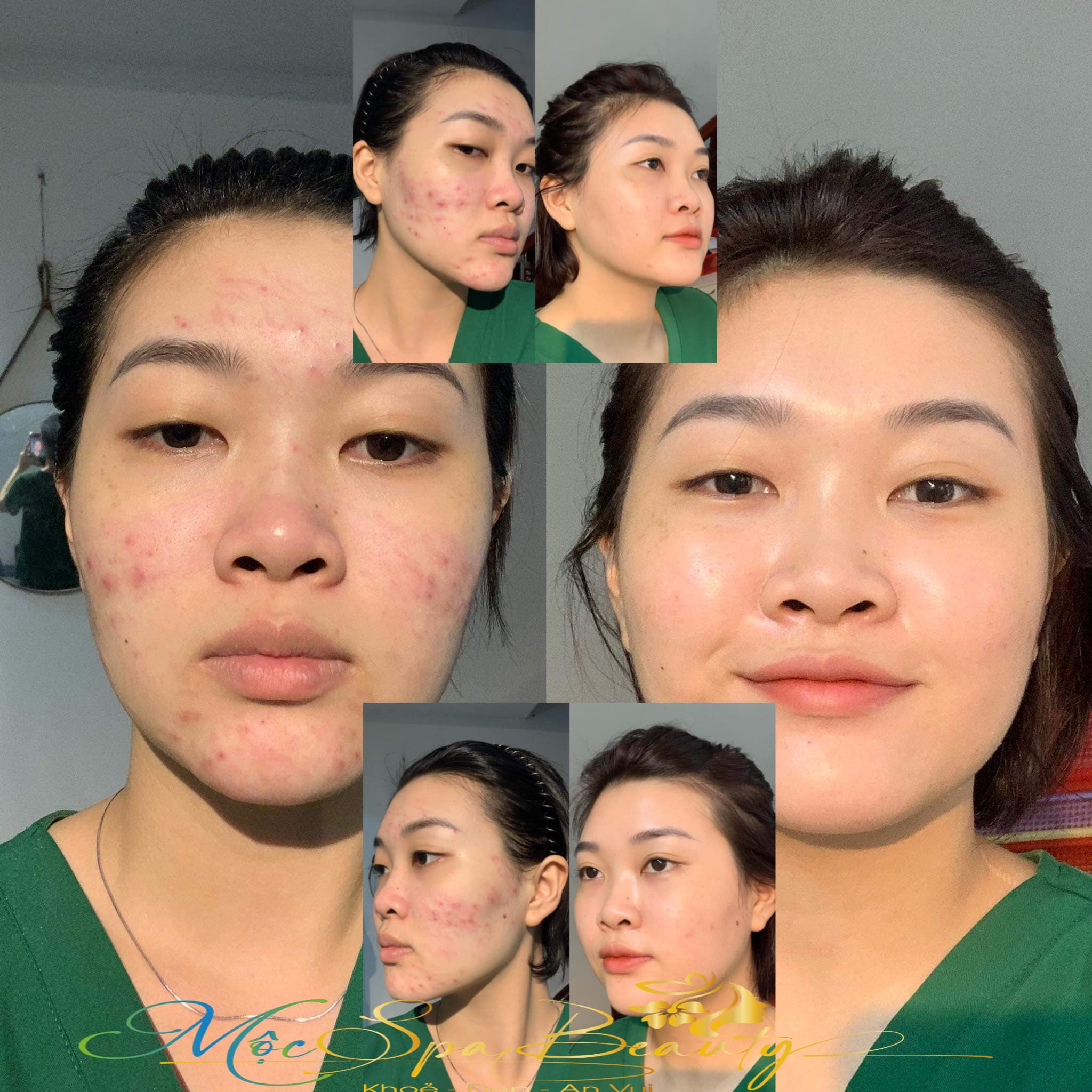 Mộc Spa