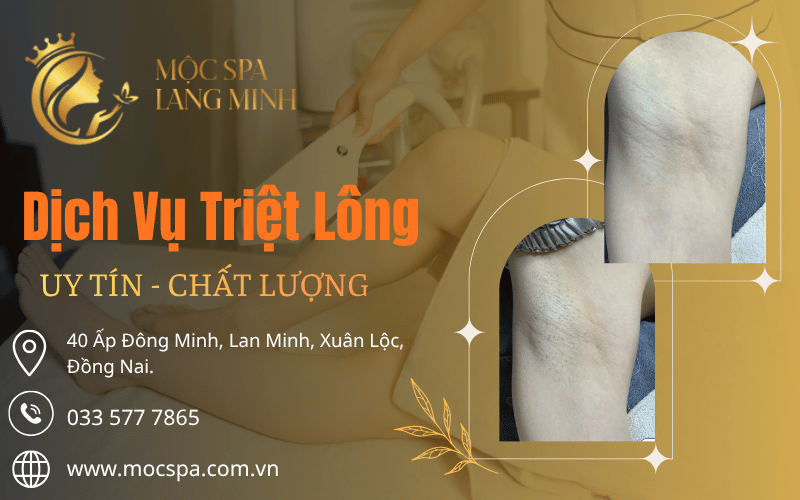 Dịch vụ triệt lông ở Xuân Lộc