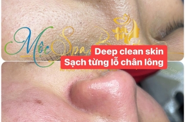 Làm Sạch Sâu