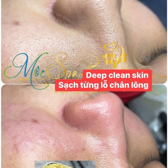 Làm Sạch Sâu
